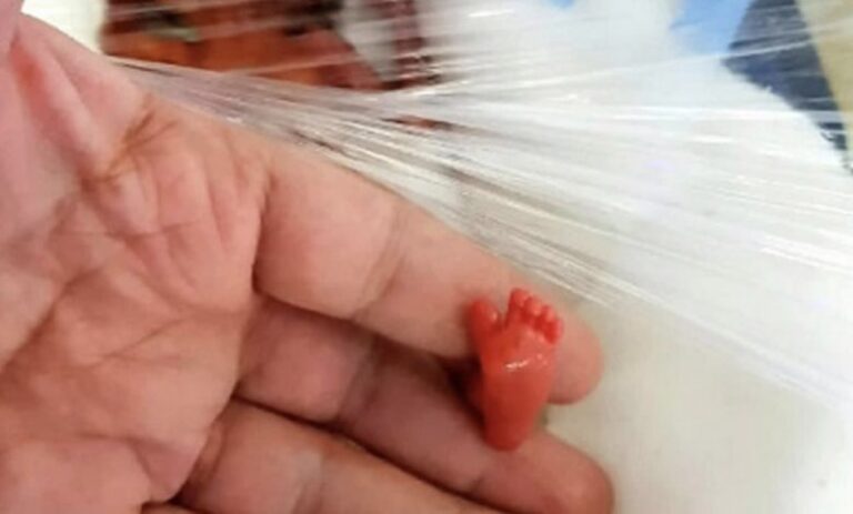 Elle pesait moins d’une livre à la naissance et les médecins pensaient qu’elle ne survivrait pas.