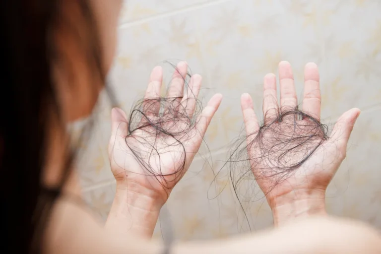 Saviez-vous que la chute des cheveux peut être un symptôme de…